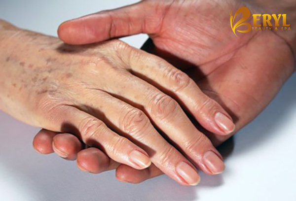 Dấu hiệu nhận biết da tay bị lão hóa