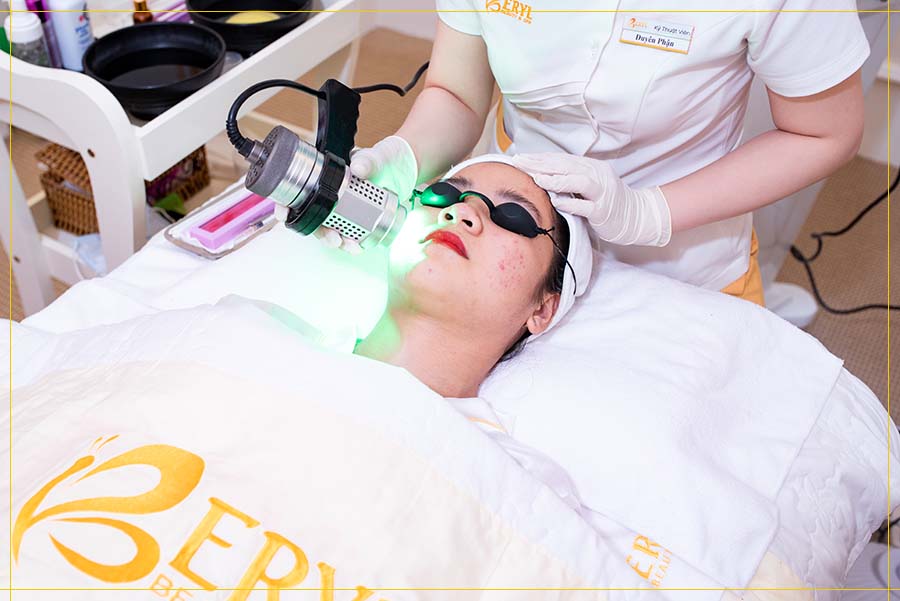 Trị mụn thâm hiệu quả bằng công nghệ Green Laser tại Beryl Beauty & Spa